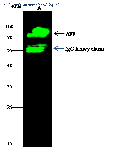 Sino Biological 12177-R003 image 1