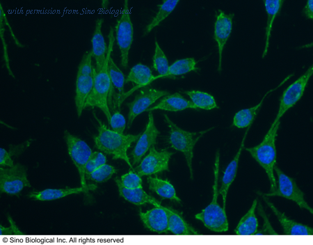 Sino Biological 12211-R001 image 1