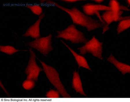 Sino Biological 12724-R110 image 1
