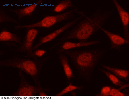 Sino Biological 12885-R103 image 1