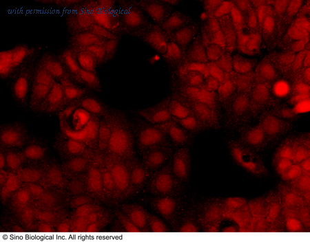 Sino Biological 13177-R139 image 1