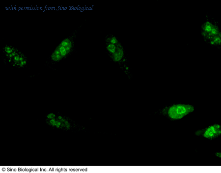 Sino Biological 13180-MM01 image 1