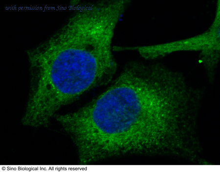 Sino Biological 13333-R004 image 1