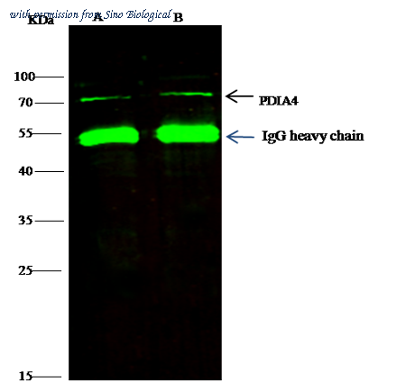 Sino Biological 13333-R020 image 1