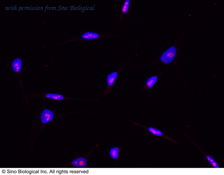 Sino Biological 13913-R002 image 1