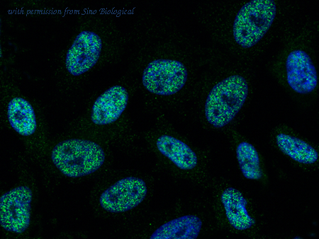 Sino Biological 13921-MM01 image 1