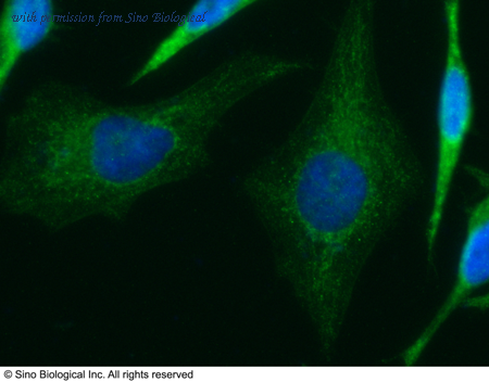 Sino Biological 14206-MM04 image 1