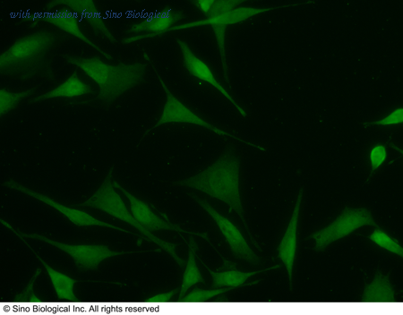 Sino Biological 14258-MM07 image 1