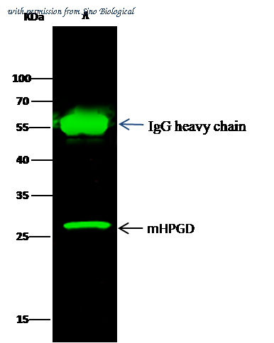 Sino Biological 50531-R101 image 1