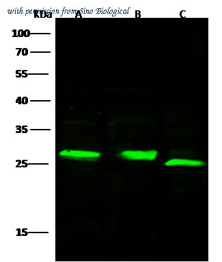 Sino Biological 50539-R104 image 1