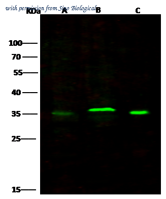 Sino Biological 90189-R104 image 1