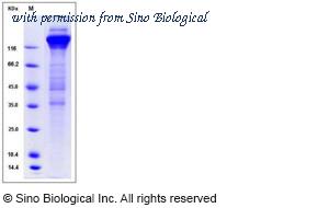 Sino Biological 10202-V02H1 image 1