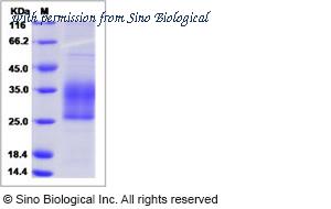 Sino Biological 10324-H08H image 1