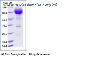 Sino Biological 10402-H02H image 1