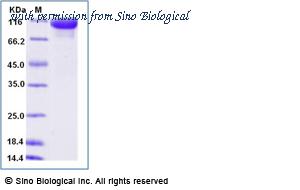 Sino Biological 10700-H08H-B image 1