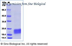 Sino Biological 10977-H08S image 1