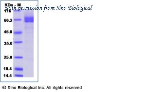 Sino Biological 11147-H01H image 1