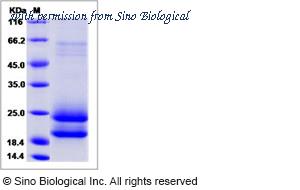 Sino Biological 11273-H08H image 1