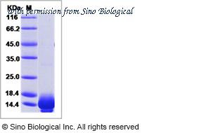 Sino Biological 11330-H07E image 1