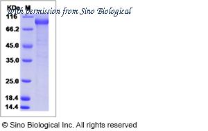 Sino Biological 11514-H02H image 1