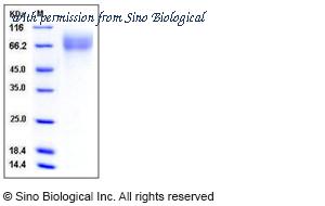 Sino Biological 11576-C02H image 1