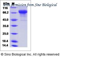 Sino Biological 11972-V08B image 1