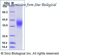 Sino Biological 12283-H08H image 1