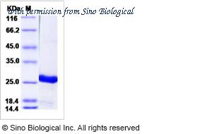Sino Biological 12440-H08E image 1