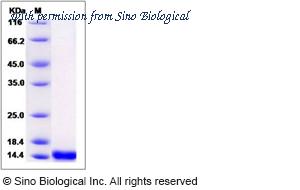 Sino Biological 12577-HNAE image 1