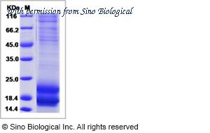 Sino Biological 13235-H08H image 1