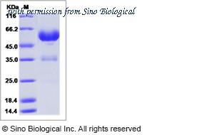 Sino Biological 13257-H02H image 1