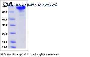 Sino Biological 13624-H02H image 1