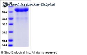 Sino Biological 13624-H08H image 1