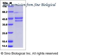 Sino Biological 13647-H05H image 1