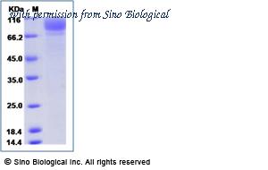 Sino Biological 14009-H07H image 1