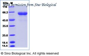 Sino Biological 15698-H02H image 1