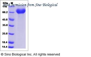 Sino Biological 15789-H08H image 1