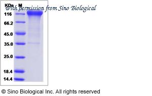 Sino Biological 15878-H02H image 1