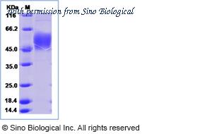 Sino Biological 15882-H07H image 1