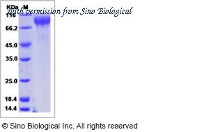 Sino Biological 15992-H08H image 1