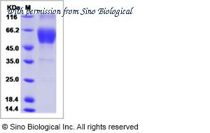 Sino Biological 16023-H02H image 1
