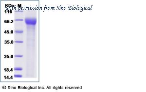 Sino Biological 16058-H08H image 1