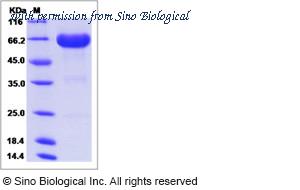 Sino Biological 16059-H02H image 1