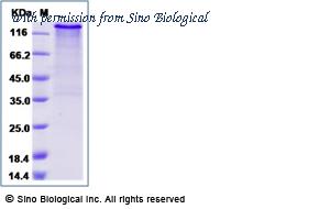 Sino Biological 16064-H02H image 1