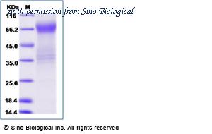 Sino Biological 16083-H02H image 1