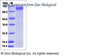 Sino Biological 16139-H02H image 1