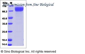 Sino Biological 16140-H02H image 1