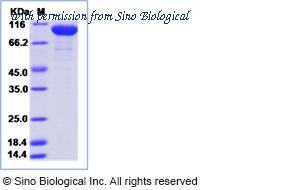 Sino Biological 17064-H08H image 1