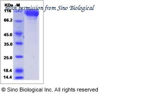 Sino Biological 40335-V02H image 1