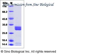 Sino Biological 40467-V31B image 1